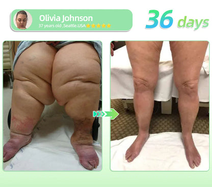 𝑶𝒇𝒇𝒊𝒄𝒊𝒂𝒍 𝑺𝒕𝒐𝒓𝒆| 𝐃ОСТІА®💟𝙂 𝐋 Р–𝟏 𝑺𝑰𝑿 𝑰𝑵-𝑶𝑵𝑬 𝑯𝒆𝒂𝒍𝒕𝒉 𝑺𝒐𝒍𝒖𝒕𝒊𝒐𝒏 𝑶𝒓𝒂𝒍 𝑳𝒊𝒒𝒖𝒊𝒅  (𝐉𝐮𝐬𝐭 𝐨𝐧𝐜𝐞 𝐚 𝐝𝐚𝐲, 𝐯𝐢𝐬𝐢𝐛𝐥𝐞 𝐜𝐡𝐚𝐧𝐠𝐞𝐬 𝐢𝐧 𝟕 𝐝𝐚𝐲𝐬）🇺🇸 𝐅𝐨𝐫 𝐨𝐛𝐞𝐬𝐢𝐭𝐲, 𝐜𝐚𝐫𝐝𝐢𝐨𝐯𝐚𝐬𝐜𝐮𝐥𝐚𝐫 𝐡𝐞𝐚𝐥𝐭𝐡, 𝐝𝐢𝐚𝐛𝐞𝐭𝐞𝐬, 𝐬𝐥𝐞𝐞𝐩 𝐚𝐩𝐧𝐞𝐚, 𝐣𝐨𝐢𝐧𝐭 𝐢𝐬𝐬𝐮𝐞𝐬, 𝐚𝐧𝐝 𝐦𝐨𝐫𝐞